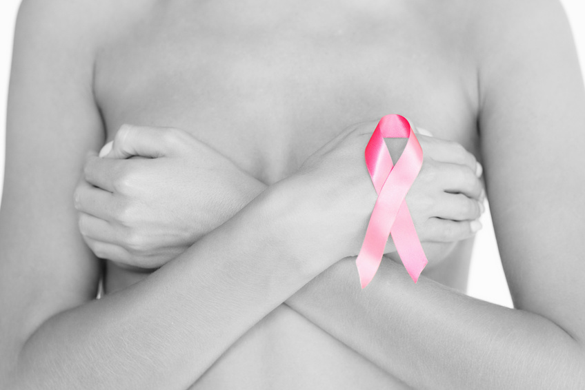 乳腺外科は乳がん専門の診療科になります。